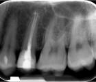 endodonzia