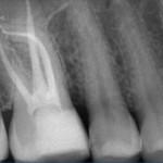 endodonzia